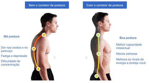 Resultado de imagem para antes e depois corretor postural