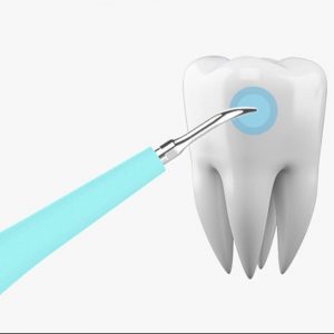 removedor de placas e tártaro dentário
